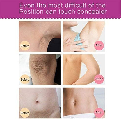 CREMA PARA BLANQUEAR LAS ZONAS INTIMAS