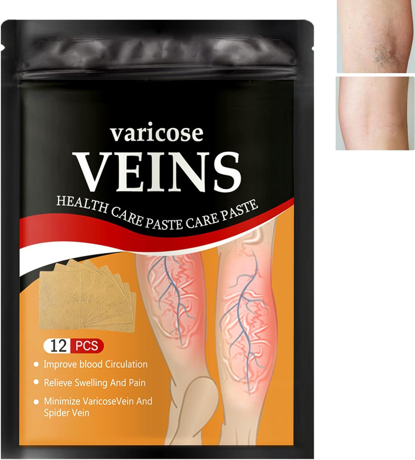 PARCHES PARA VARICES