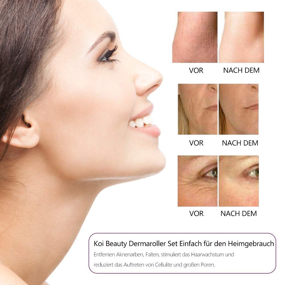 LED DE MICROAGUJAS VIBRACIÓN