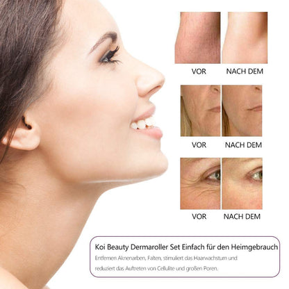 LED DE MICROAGUJAS VIBRACIÓN