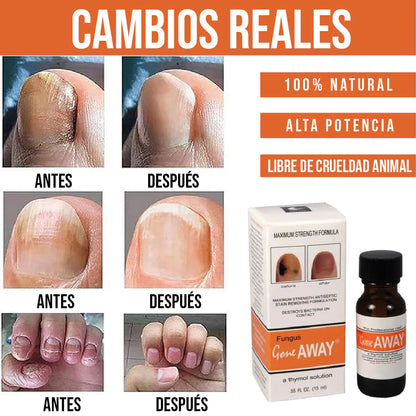 GOTERO PARA HONGOS EN LAS UÑAS