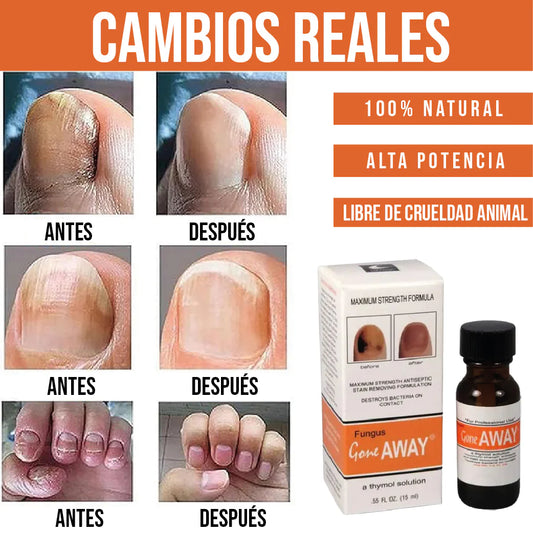 GOTERO PARA HONGOS EN LAS UÑAS