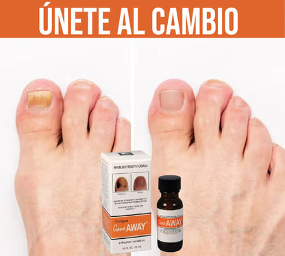 GOTERO PARA HONGOS EN LAS UÑAS